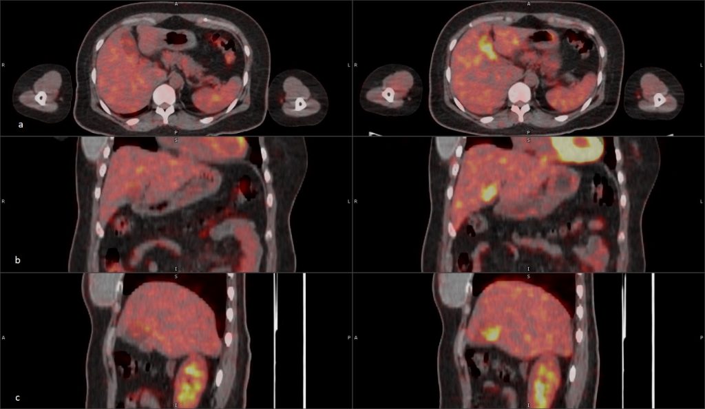 PET Basics 2 - Asian Nuclear Medicine Board (ANMB)
