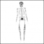 Osteology case 8